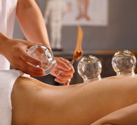 ครอบแก้ว (Cupping Therapy) ศาสตร์การแพทย์แผนจีนเพื่อช่วยคลายกล้ามเนื้อและบรรเทาอาการปวด