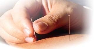 การฝังเข็มในโรคกล้ามเนื้อหดเกร็ง (Dry needling puncture in Myofascial pain syndrome)